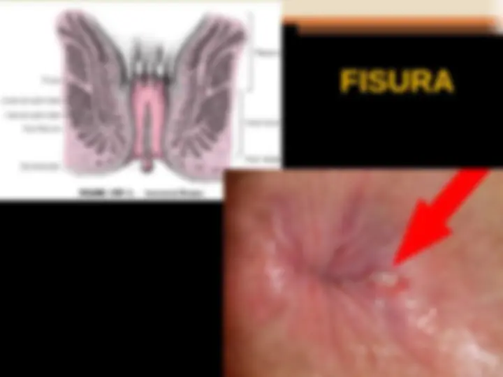 pf24