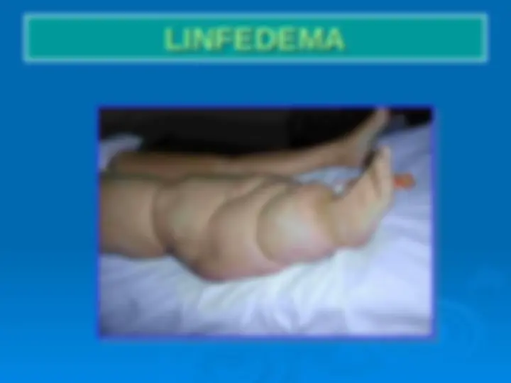 pf33