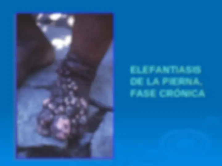 pf3a