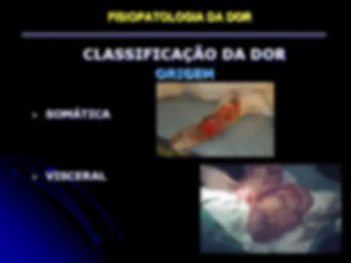 pf28