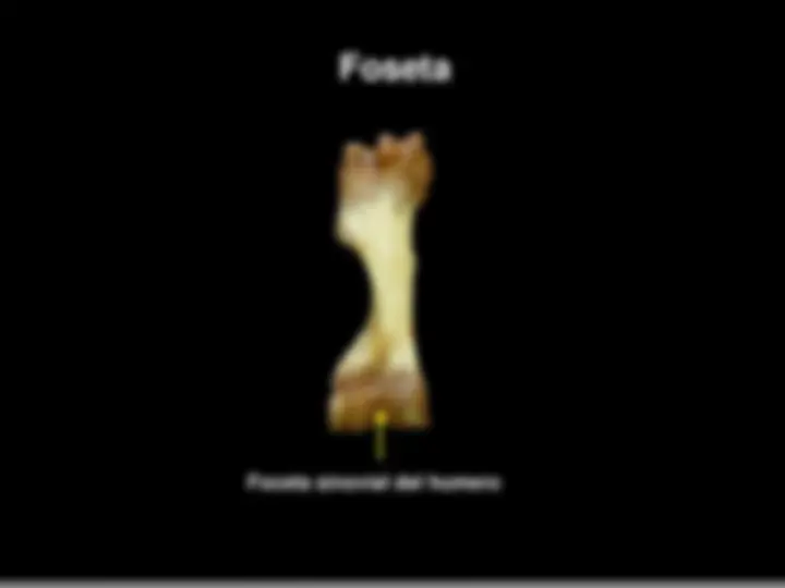 pf3a