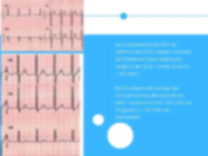 pfe
