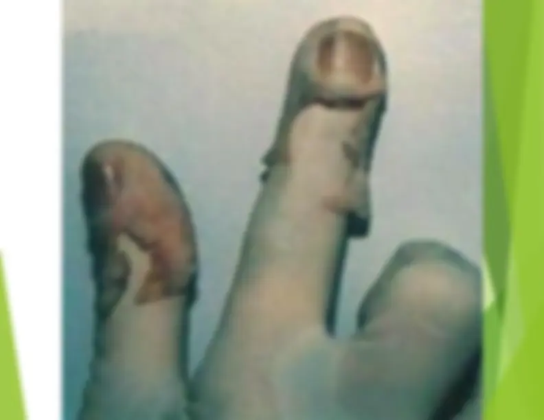 pf20