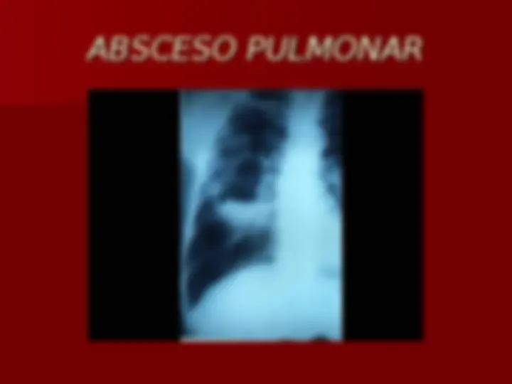 pf2f