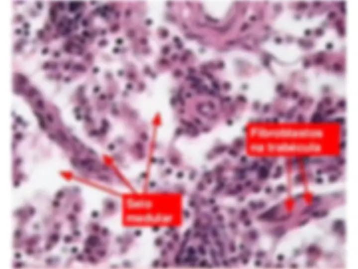 pf44