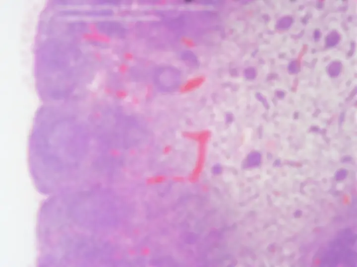 pf26