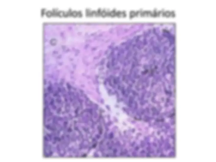 pf34