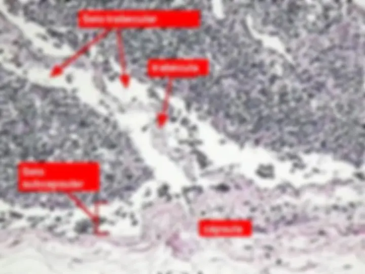 pf29