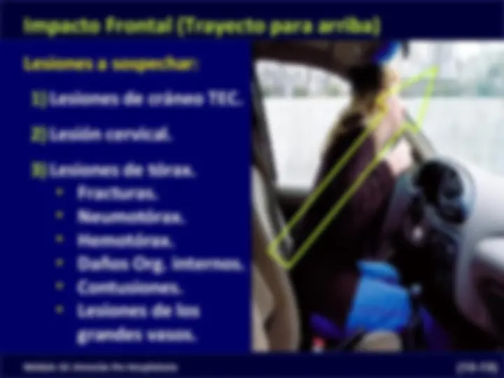 pfe