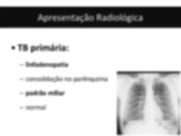 pf20