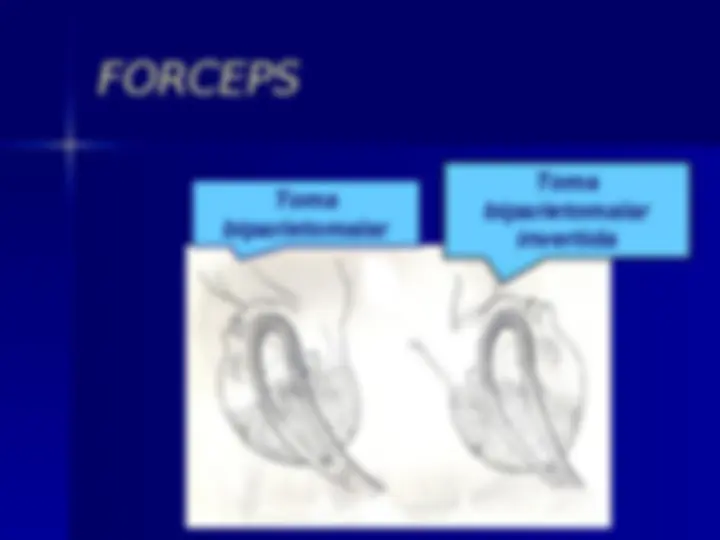 pf13