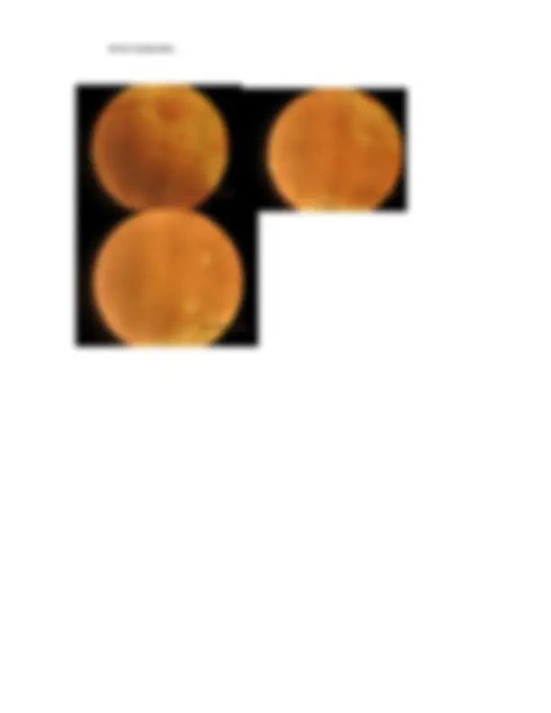 pf12
