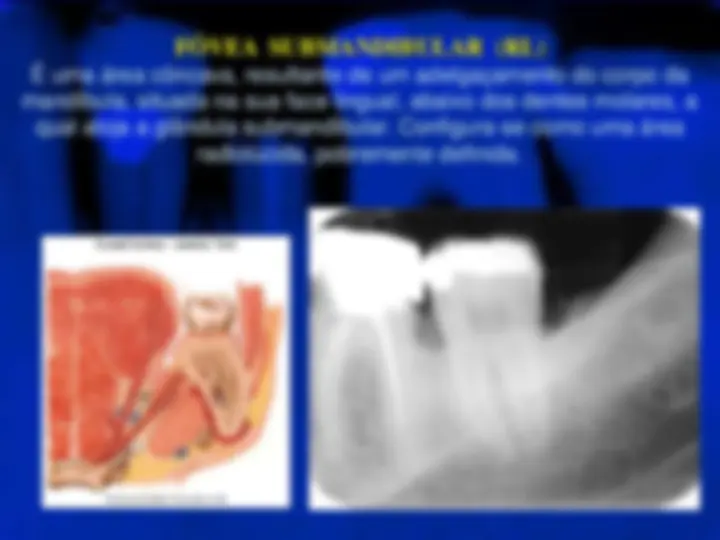 pf32