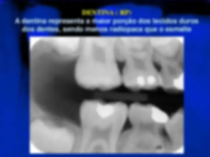 pf5