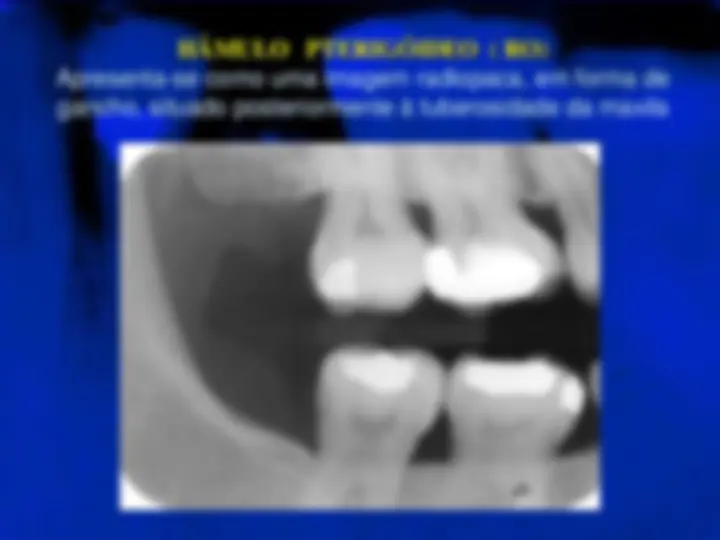 pf24