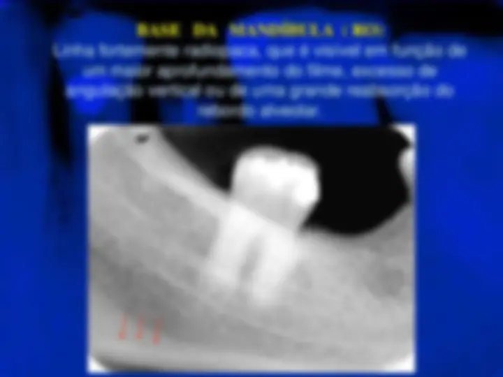 pf33