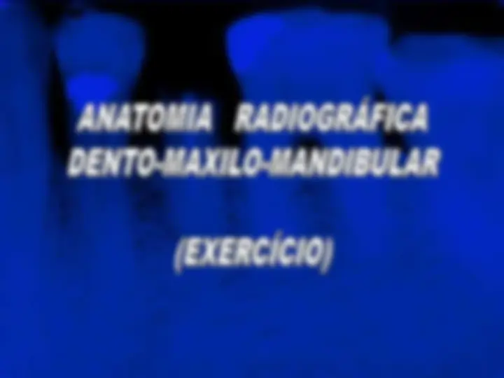 pf34