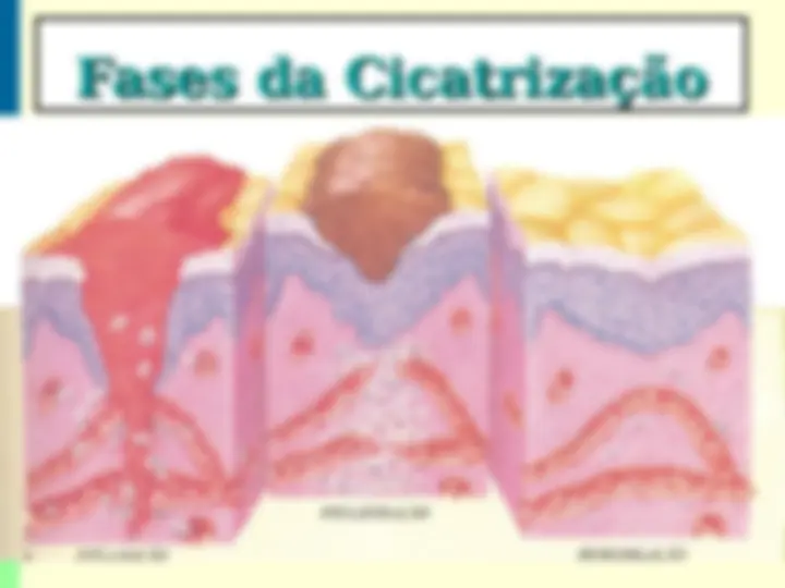 pf21