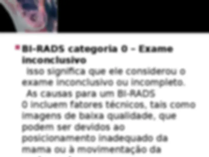 pfe