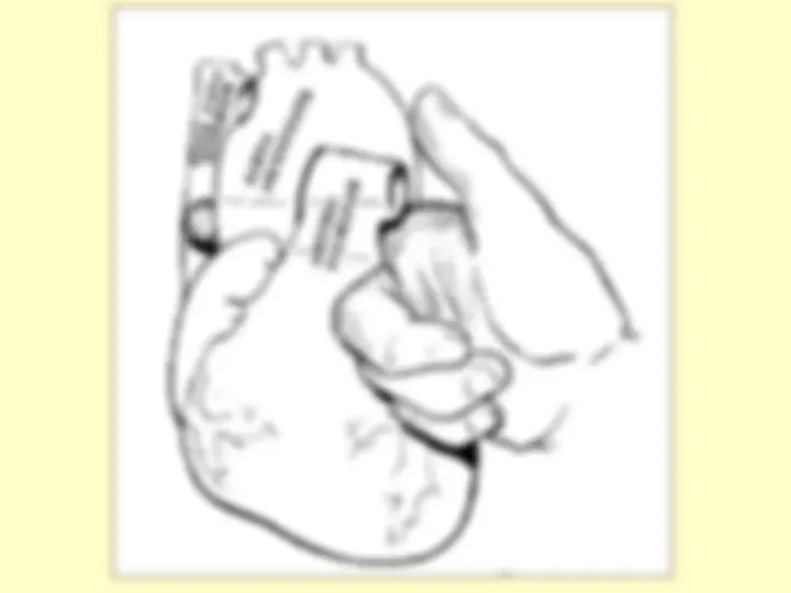 pf24