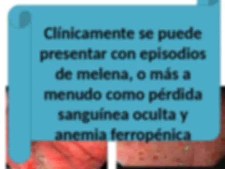 pfe