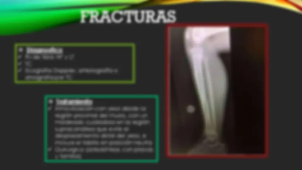 pf24