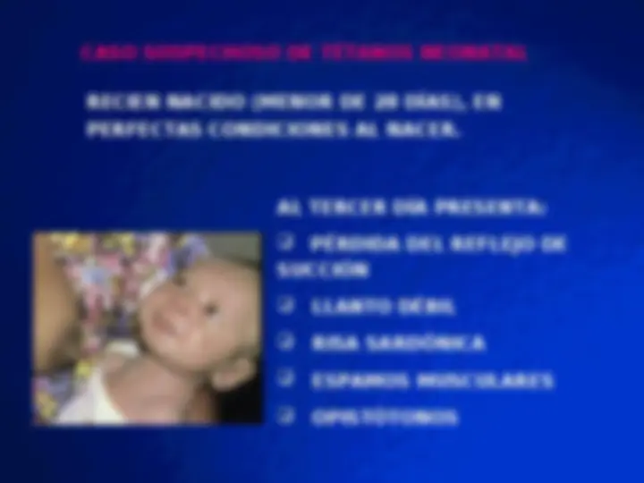 pfe