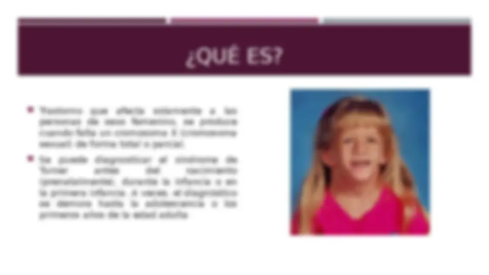 pfe