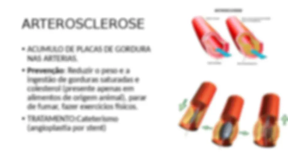 pf15