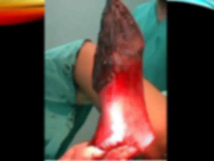 pf51