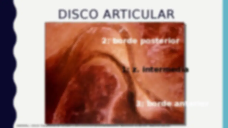 pf5