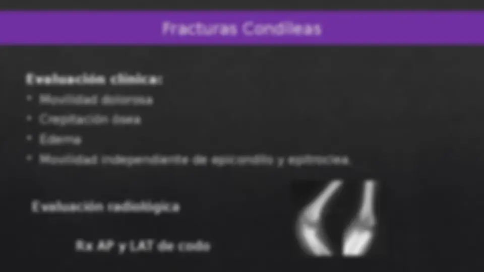 pf14