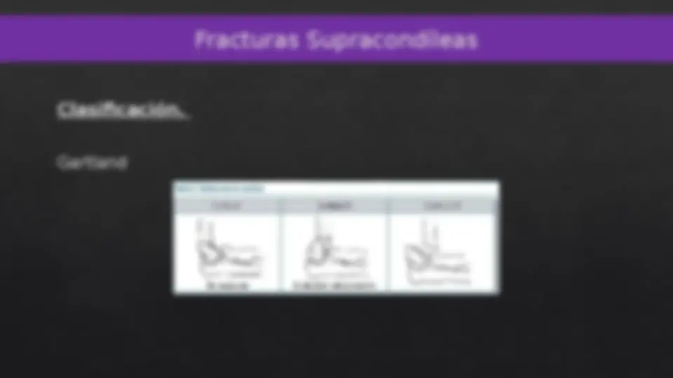 pfe