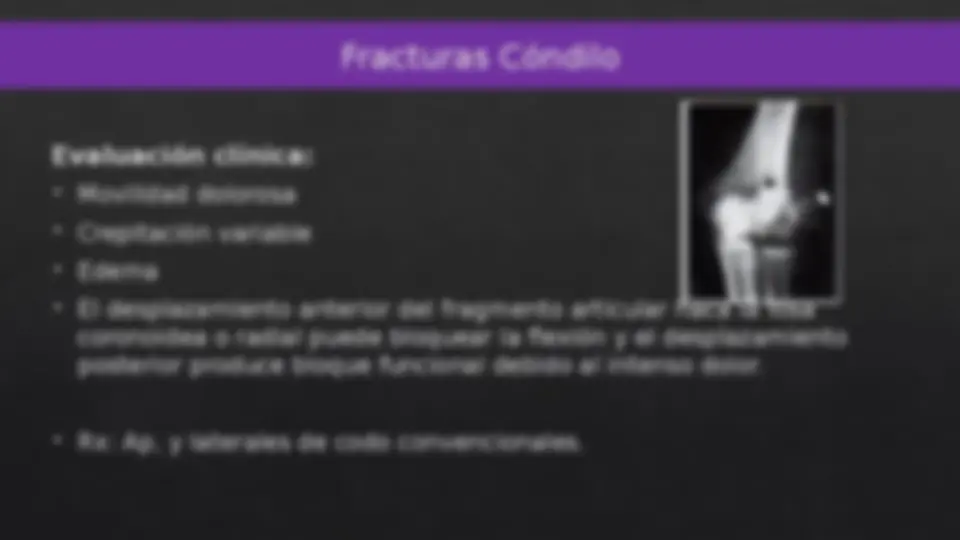 pf18