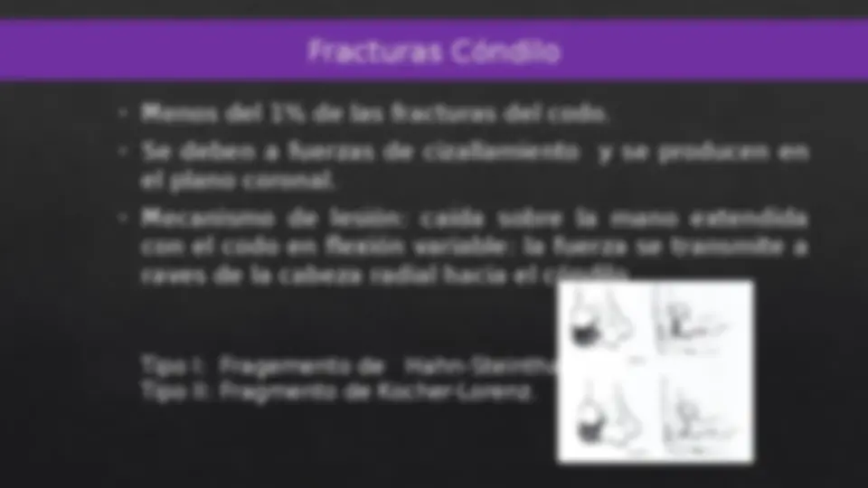 pf17
