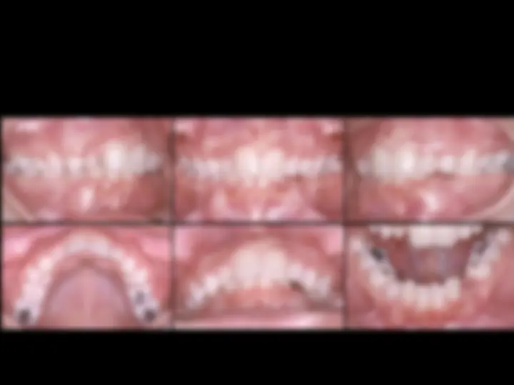 pf4