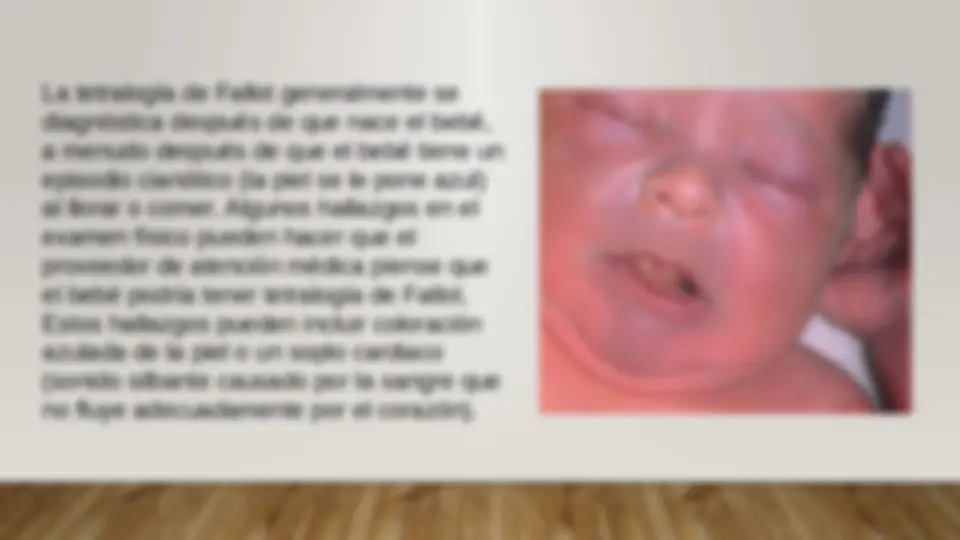 pf13