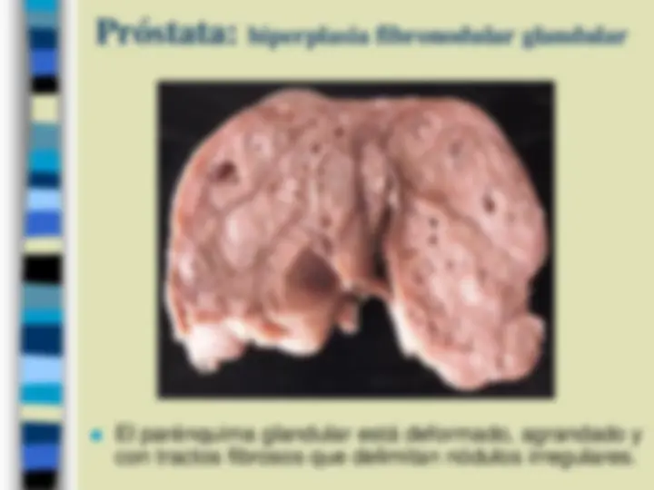 pf26