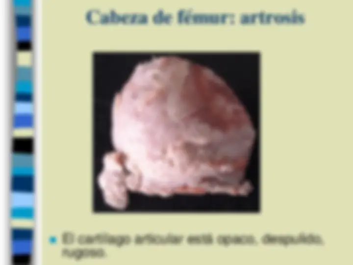 pf27