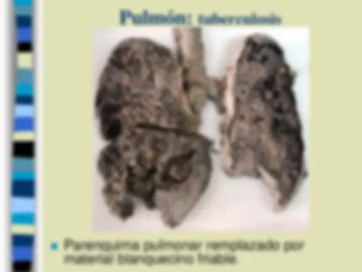pf23