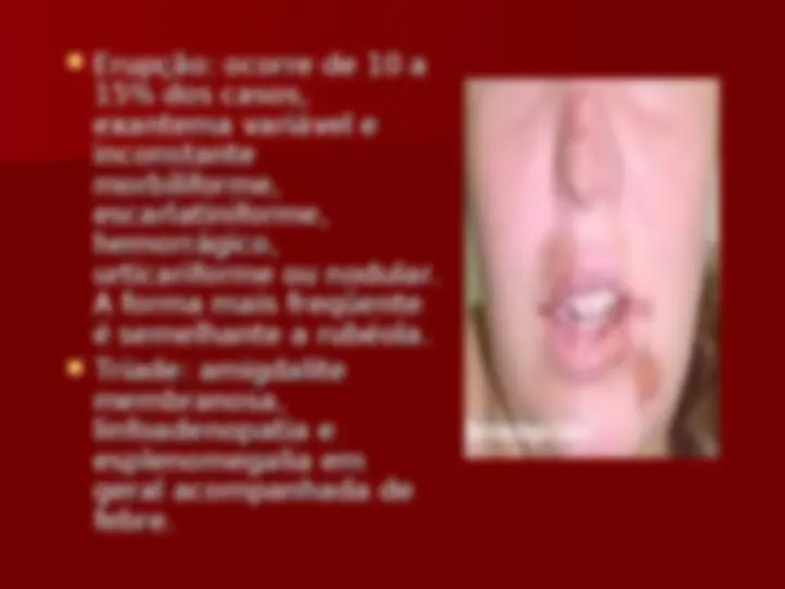 pf34