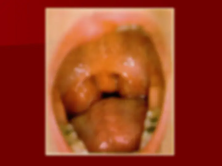 pf39