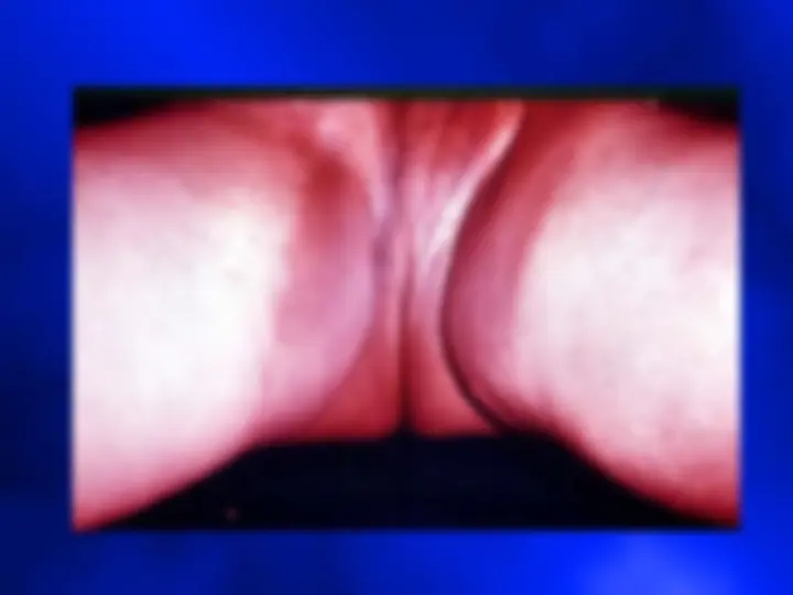 pf32