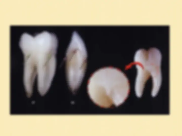 pf28