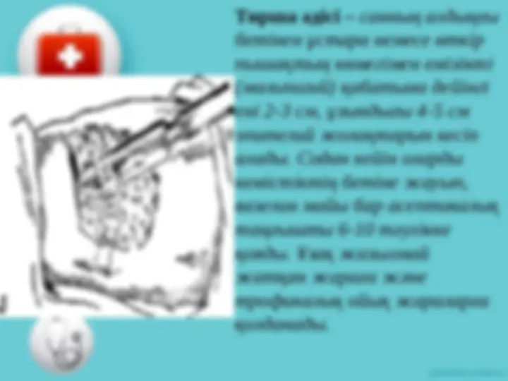 Жақында қынап эротикасы