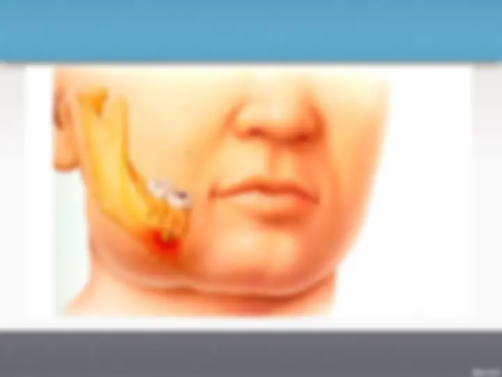 pf4