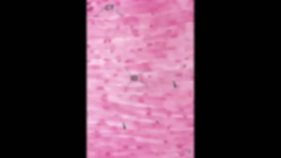 pf5