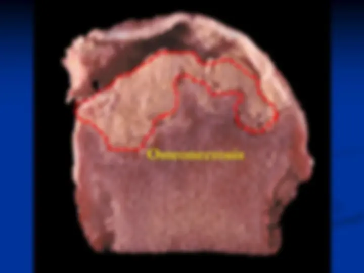 pf38