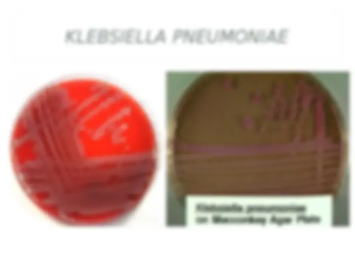 pf4a