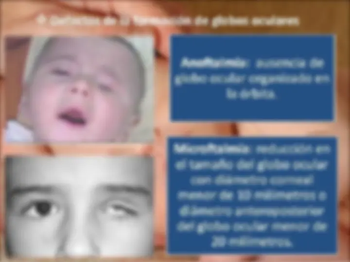 pf27